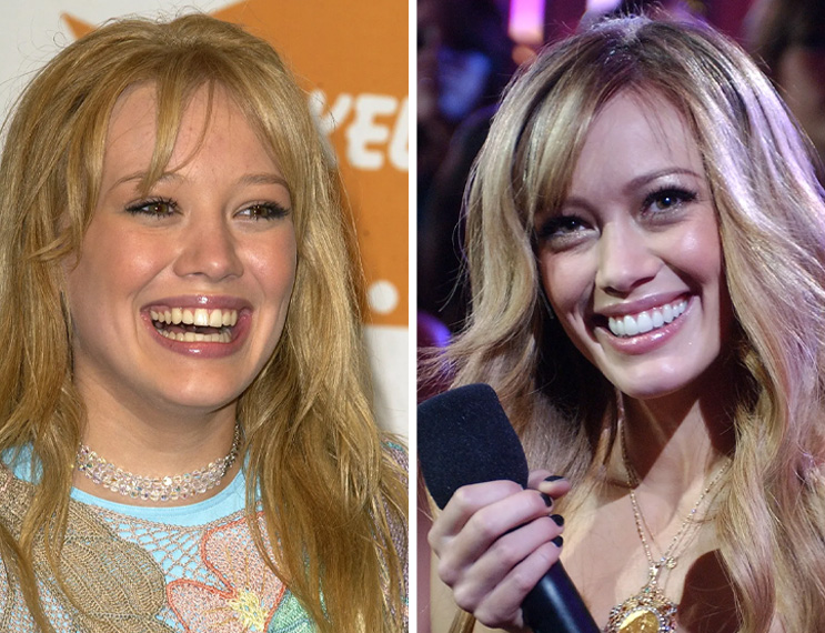 Trident Smiles Dental How do celebrities get their "Hollywood Smile"?